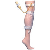 CATHETER EXTERNAL SHEATH HOLDER 12/BX | Preferred Medical